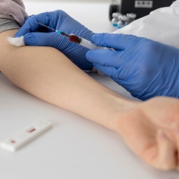 Blood Sampling