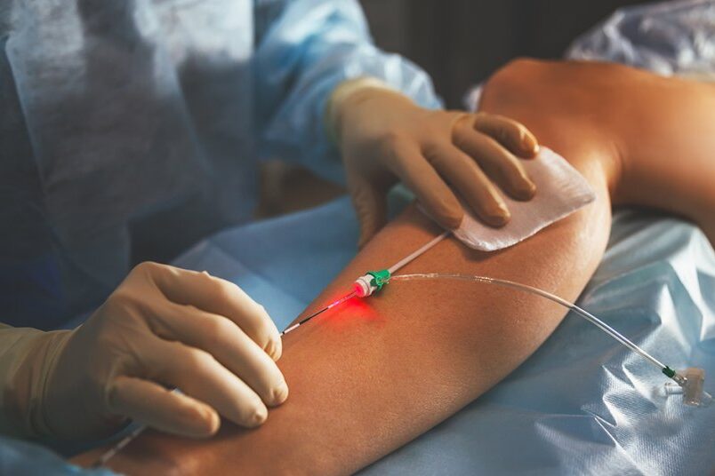 Vascular Surgeon